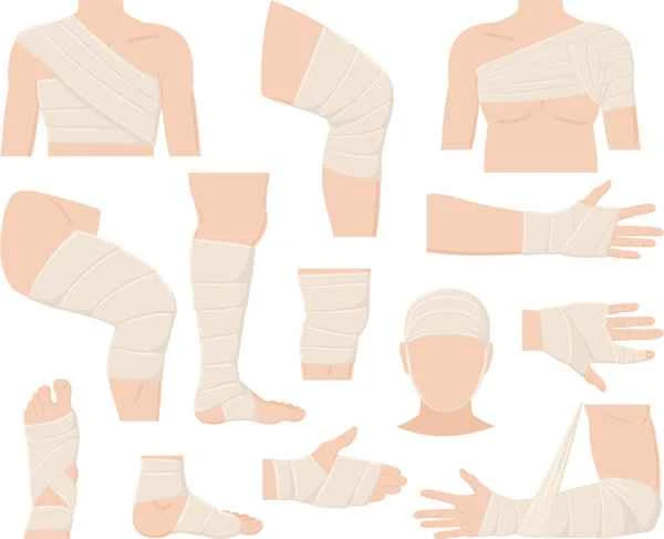 Is paralytic ileus caused by a fracture serious?