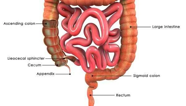 Does duodenal obstruction require resection?