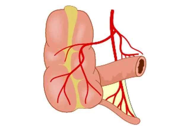 Does chronic pancreatitis cause intestinal obstruction?