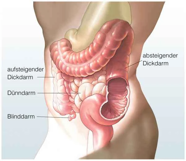 How to relieve urinary difficulties in colon cancer?