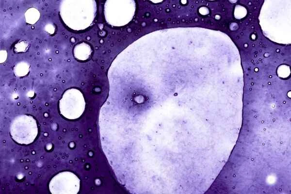 How do intestinal polyps develop?