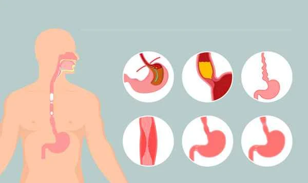 Which 3 symptoms indicate stomach cancer?