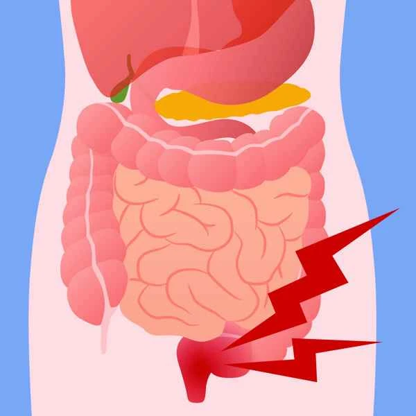 The characteristics of several types of intestinal obstruction are as follows: