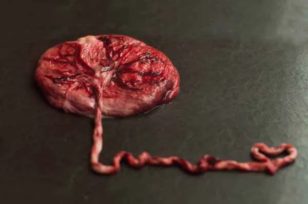 How to distinguish between gastric polyps and intestinal fossils