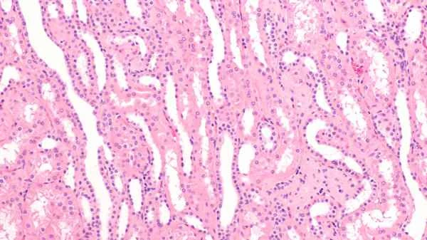 Are sigmoid colon leiomyomas benign?