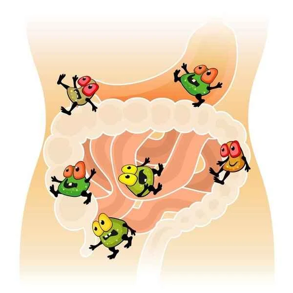 How to determine the location of intestinal obstruction