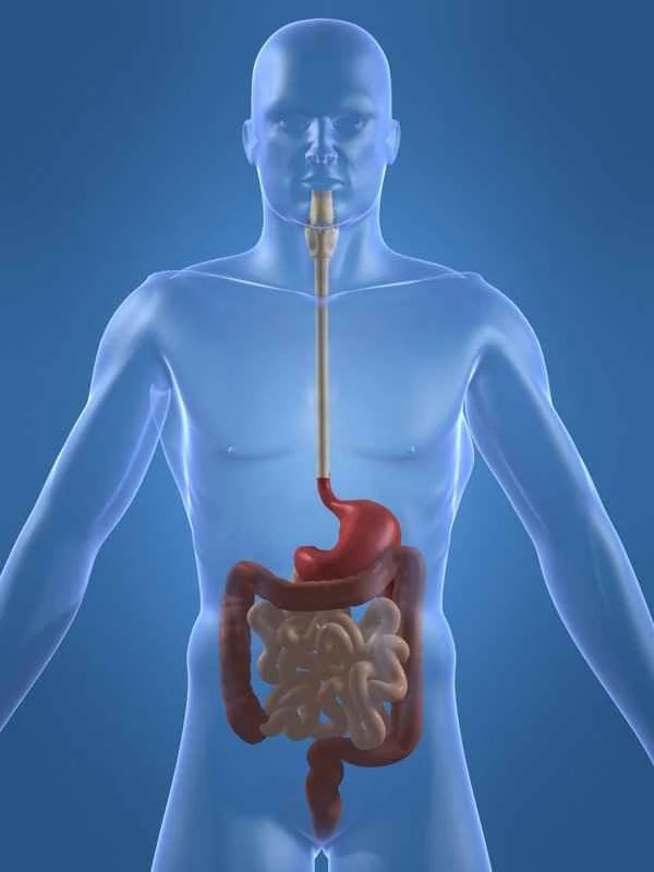 What is advanced gastric cancer?