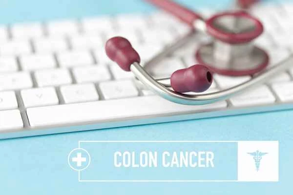 Does the absence of polyps during a colonoscopy indicate the possibility of colon cancer?