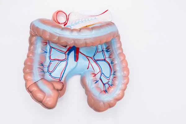 Are there any medications for treating intestinal polyps?