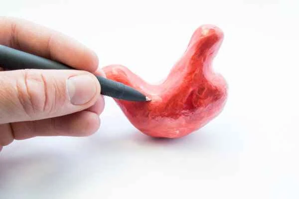 Briefly describe the treatment principles of gastric cancer