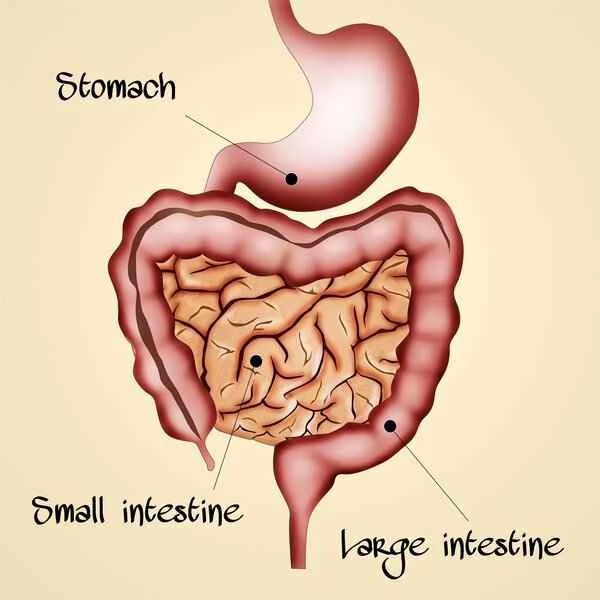 Is left-sided side stitch pain caused by intestinal polyps?